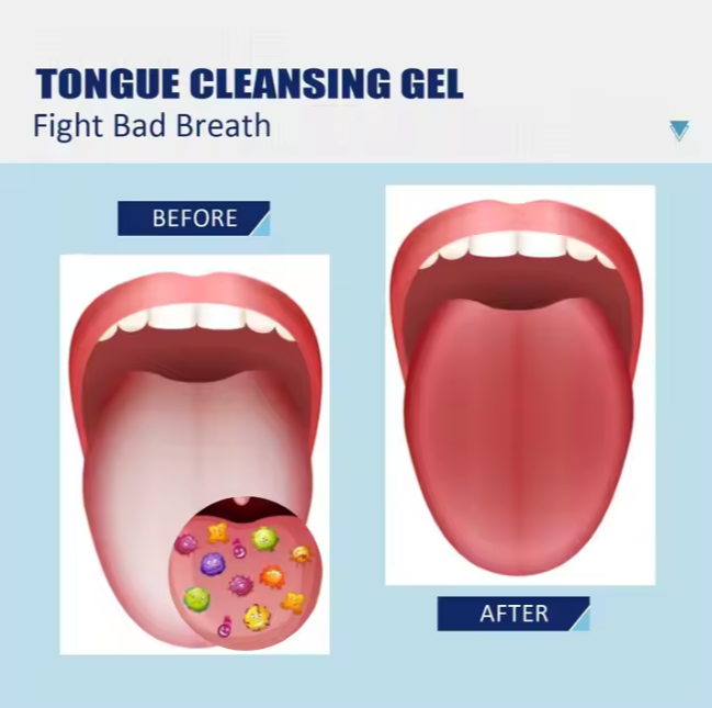Gratte Langue Contre Mauvaise Haleine💨 1 Gratte Langue Acheté=1 Nettoyant Offert