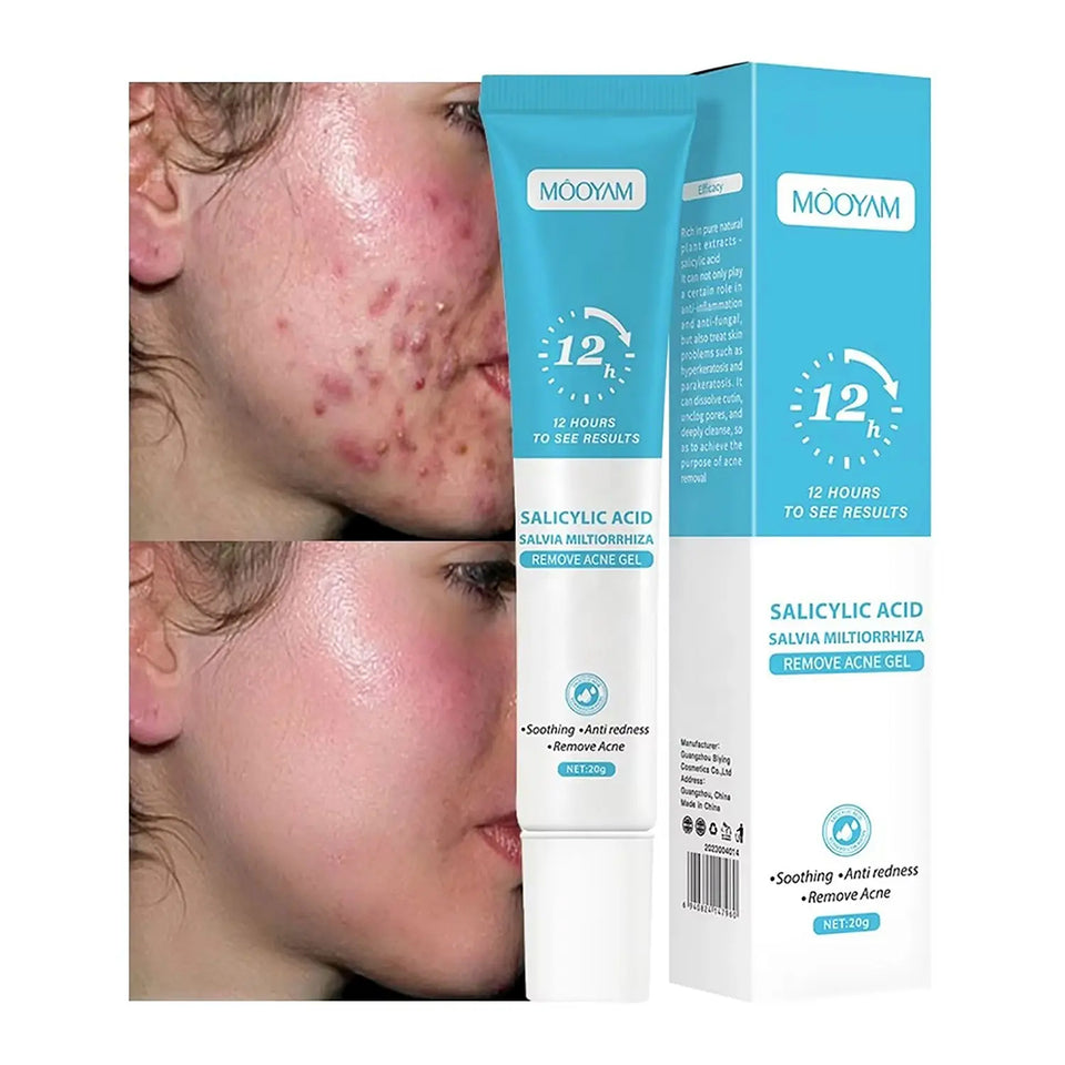 🧴 AKUNADO – Anti-Acné- Conçue pour les béninois .