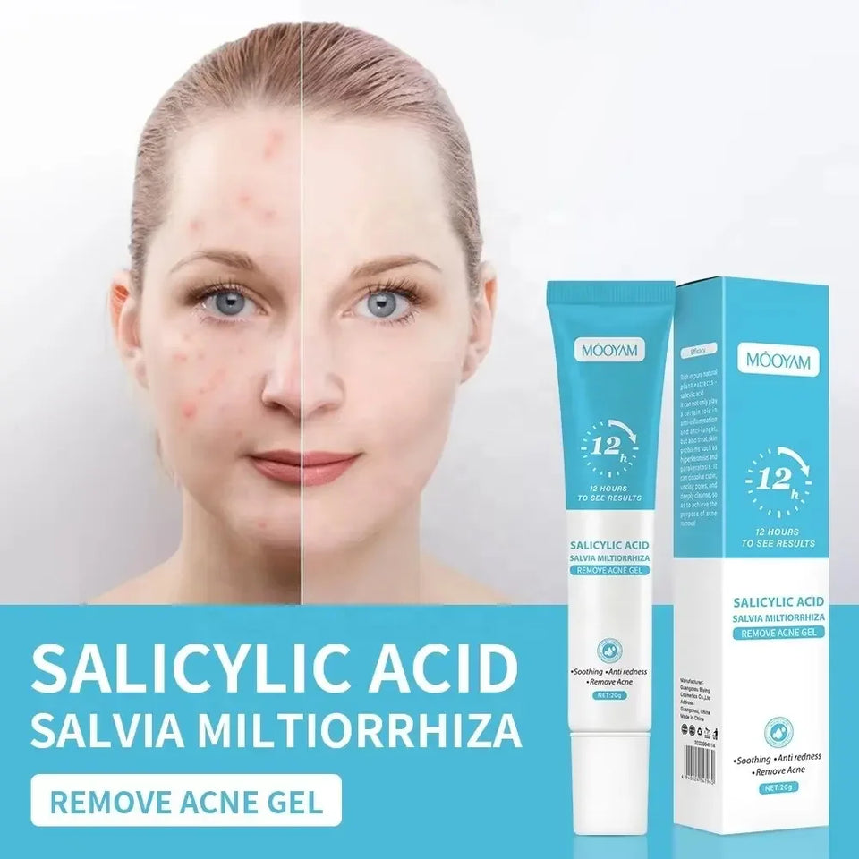 🧴 AKUNADO – Anti-Acné- Conçue pour les béninois .