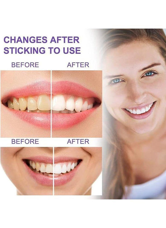 Dentifrice Blanchissant Akunado SP4