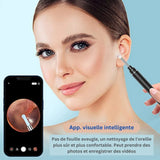 Nettoyeur D'otoscope Vidéo 3 En 1