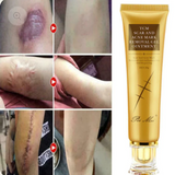 Crème Anti Cicatrice Malovax