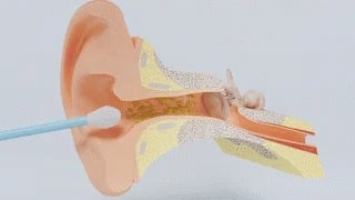 Nettoyeur D'otoscope Vidéo 3 En 1