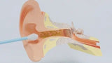 Nettoyeur D'otoscope Vidéo 3 En 1