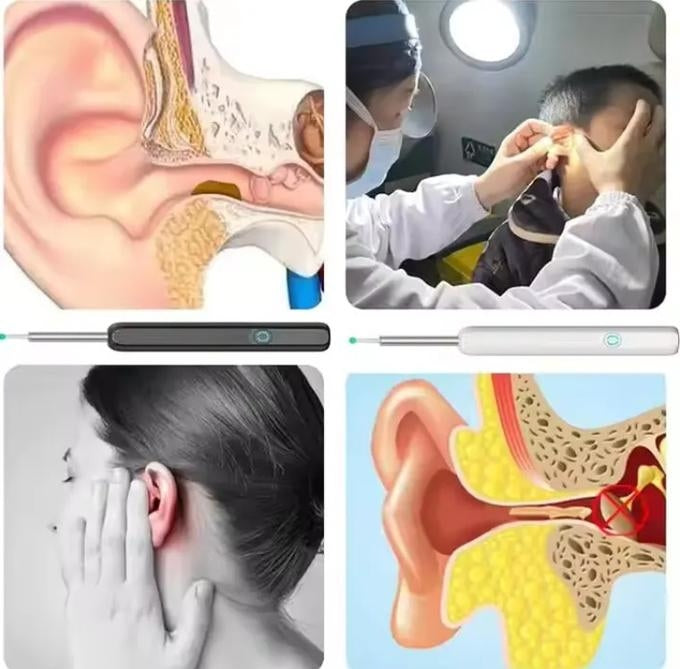 Nettoyeur D'otoscope Vidéo 3 En 1