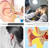 Nettoyeur D'otoscope Vidéo 3 En 1